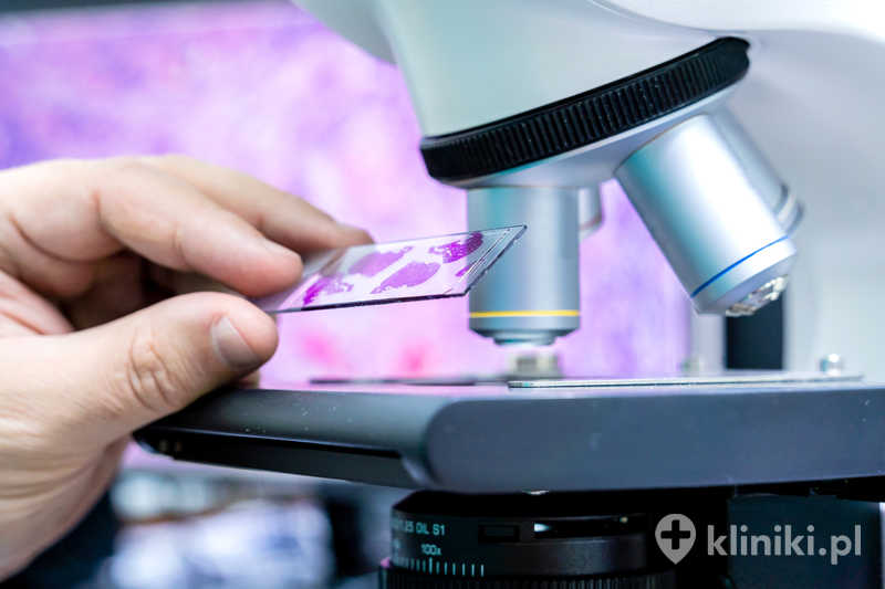 Badania biopsyjne umożliwiają ocenę komórek lub tkanek pod mikroskopem