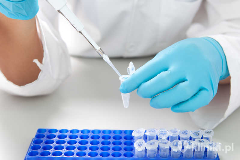 Badania nasienia mogą być rozszerzone o dodatkowe testy, np. ocenę fragmentacji DNA plemników