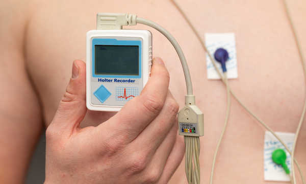 Badanie Holter EKG polega na całodobowym monitorowaniu pracy serca Badanie Holter EKG polega na całodobowym monitorowaniu pracy serca