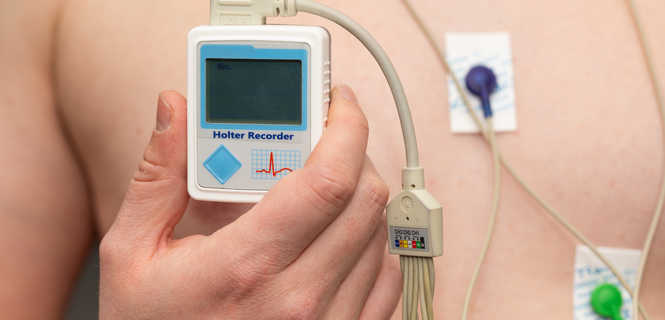 Badanie Holter EKG