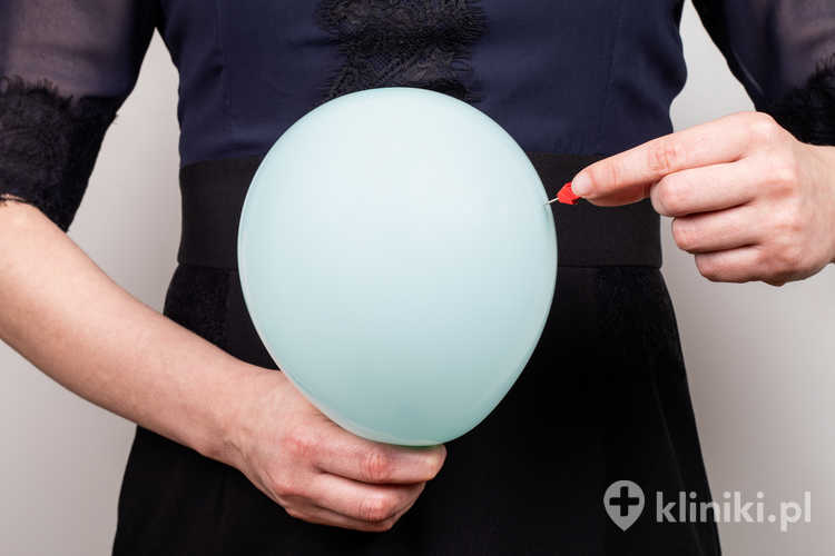 Balon żołądkowy