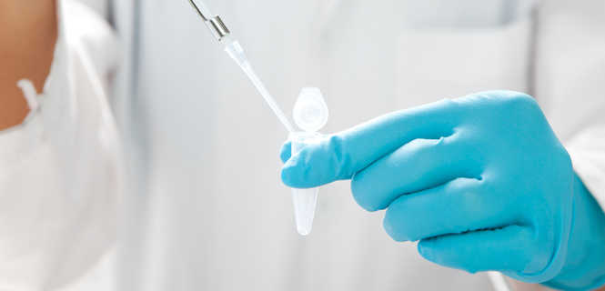 Biopsje