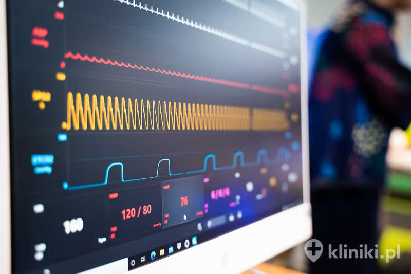 Holter ciśnieniowy umożliwia wykrycie tzw. nadciśnienia nocnego Holter ciśnieniowy umożliwia wykrycie tzw. nadciśnienia nocnego