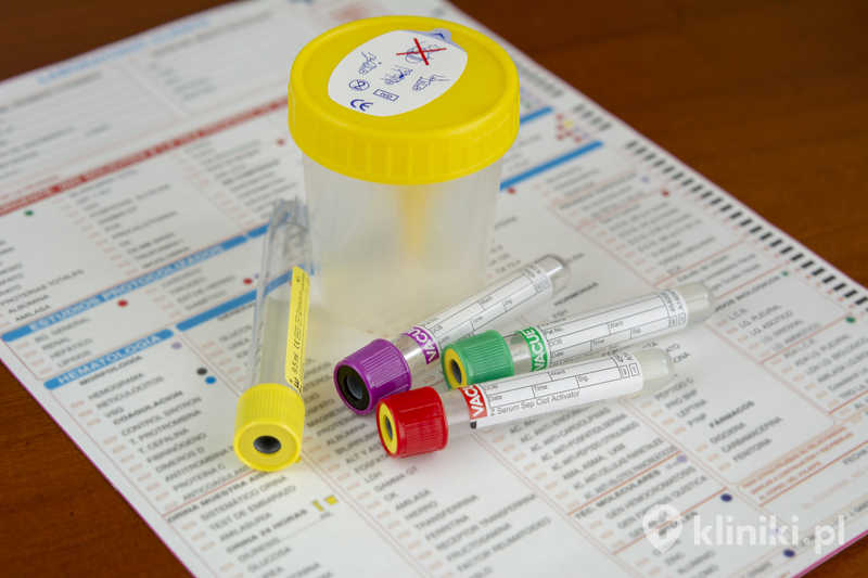 Inseminacja domaciczna jest zabiegiem mało inwazyjnym i wykonywanym ambulatoryjnie
