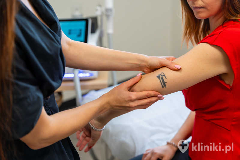 Laserowe usuwanie tatuażu działa najlepiej na ciemne pigmenty, zwłaszcza czarny Laserowe usuwanie tatuażu działa najlepiej na ciemne pigmenty, zwłaszcza czarny