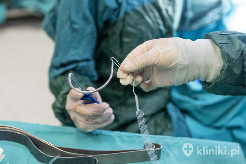 Leczenie NTM w niektórych przypadkach wymaga zastosowania metod zabiegowych lub operacyjnych