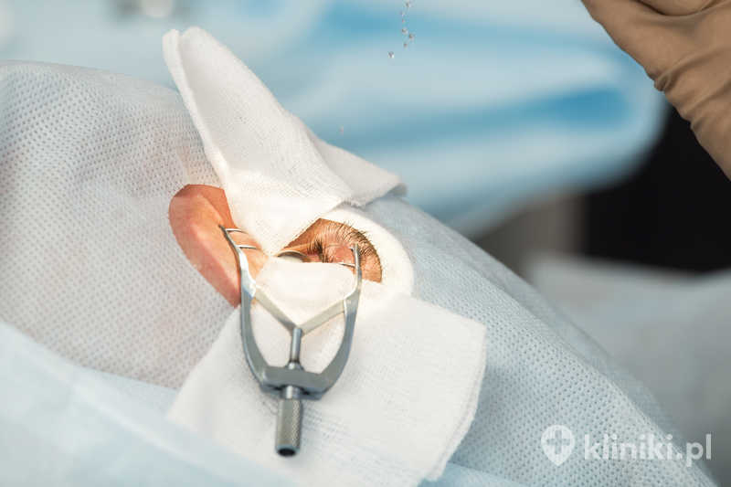 Leczenie zaćmy nowoczesną metodą fakoemulsyfikacji jest małoinwazyjne i bezpieczne dla pacjenta