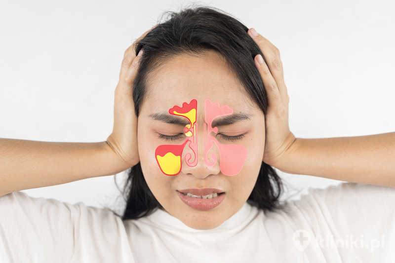 Operacja endoskopowa zatok przynosowych FESS/FEOZ polega na udrożnieniu ujść zatok i usunięciu zmian zapalnych