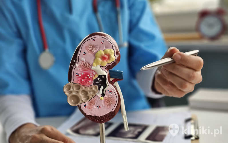 PCNL - rysunek poglądowy