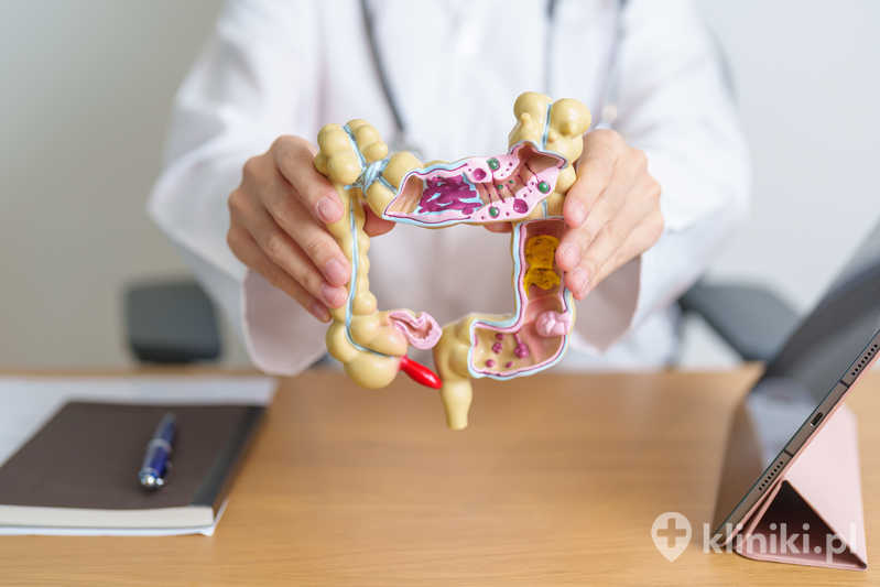 Rektoskopia to badanie endoskopowe odbytnicy wykonywane w celach diagnostycznych Rektoskopia to badanie endoskopowe odbytnicy wykonywane w celach diagnostycznych