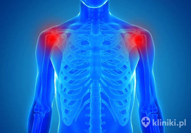 Skuteczność badania usg barku zależy także od doświadczenia lekarza prowadzącego