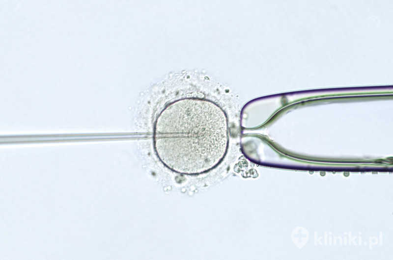Terapia in vitro umożliwia połączenie komórki jajowej z plemnikiem w warunkach laboratoryjnych. Terapia in vitro umożliwia połączenie komórki jajowej z plemnikiem w warunkach laboratoryjnych.