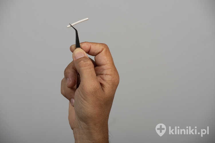 Implant antykoncepcyjny