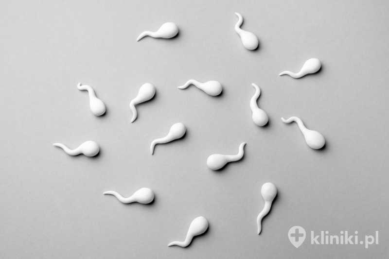 Mikrochirurgiczne zespolenie nasieniowodów daje szansę na ponowne pojawienie się plemników w nasieniu Mikrochirurgiczne zespolenie nasieniowodów daje szansę na ponowne pojawienie się plemników w nasieniu