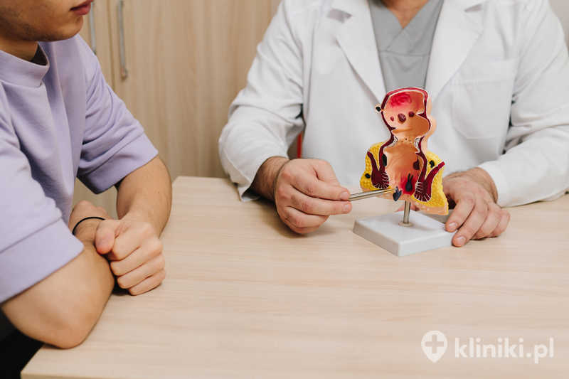 Model anatomiczny pokazujący rozmieszczenie hemoroidów w odbycie Model anatomiczny pokazujący rozmieszczenie hemoroidów w odbycie