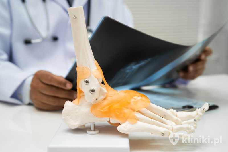 Model anatomiczny stawu skokowego człowieka Model anatomiczny stawu skokowego człowieka