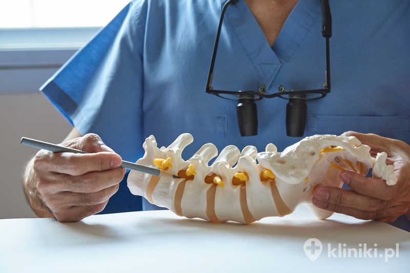 Stentoplastyka kręgosłupa polega na wprowadzeniu specjalnego stentu do wnętrza trzonu kręgowego przed podaniem cementu kostnego