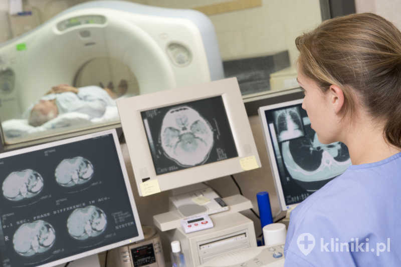 Tomografia komputerowa układu wieńcowego dostarcza szczegółowych obrazów, które ułatwiają lekarzowi postawienie rozpoznania