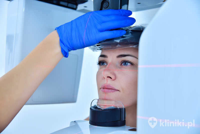 Trójwymiarowa tomografia zębów umożliwia precyzyjne wykrywanie zmian niewidocznych na standardowych zdjęciach rentgenowskich Trójwymiarowa tomografia zębów umożliwia precyzyjne wykrywanie zmian niewidocznych na standardowych zdjęciach rentgenowskich