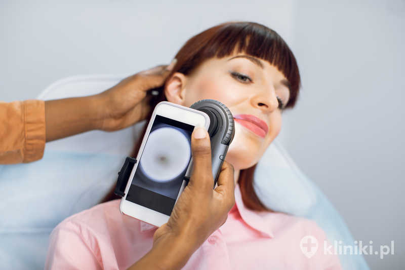 Wideodermatoskopia to zaawansowana forma dermatoskopii, która umożliwia cyfrowe fotografowanie i długoterminowe monitorowanie zmian skórnych Wideodermatoskopia to zaawansowana forma dermatoskopii, która umożliwia cyfrowe fotografowanie i długoterminowe monitorowanie zmian skórnych