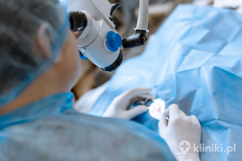 Zabieg usunięcia zaćmy metodą ultradźwiękowej fakoemulsyfikacji z implantacją standardowej soczewki sferycznej pozwala na poprawę ostrości widzenia Zabieg usunięcia zaćmy metodą ultradźwiękowej fakoemulsyfikacji z implantacją standardowej soczewki sferycznej pozwala na poprawę ostrości widzenia
