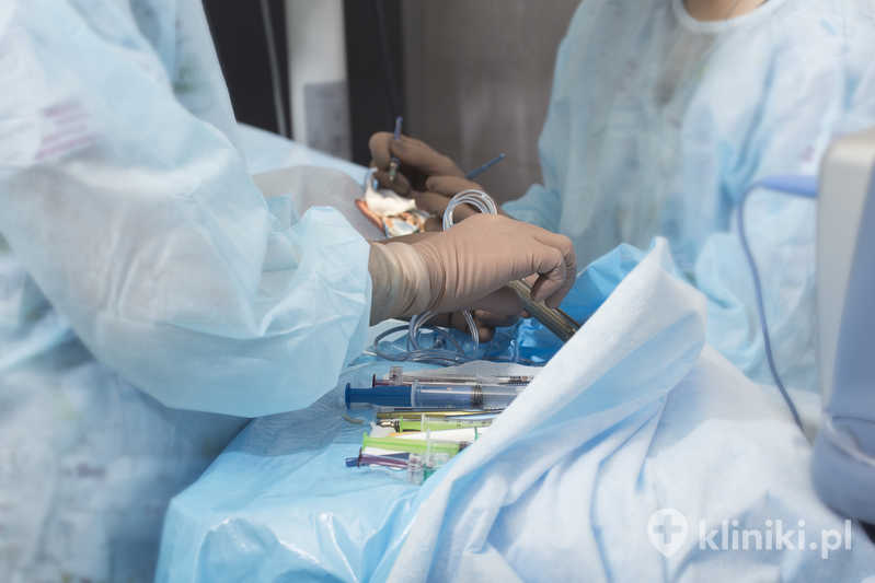Zabieg usunięcia zaćmy z implantacją soczewki torycznej jest wykonywany najczęściej w znieczuleniu miejscowym Zabieg usunięcia zaćmy z implantacją soczewki torycznej jest wykonywany najczęściej w znieczuleniu miejscowym