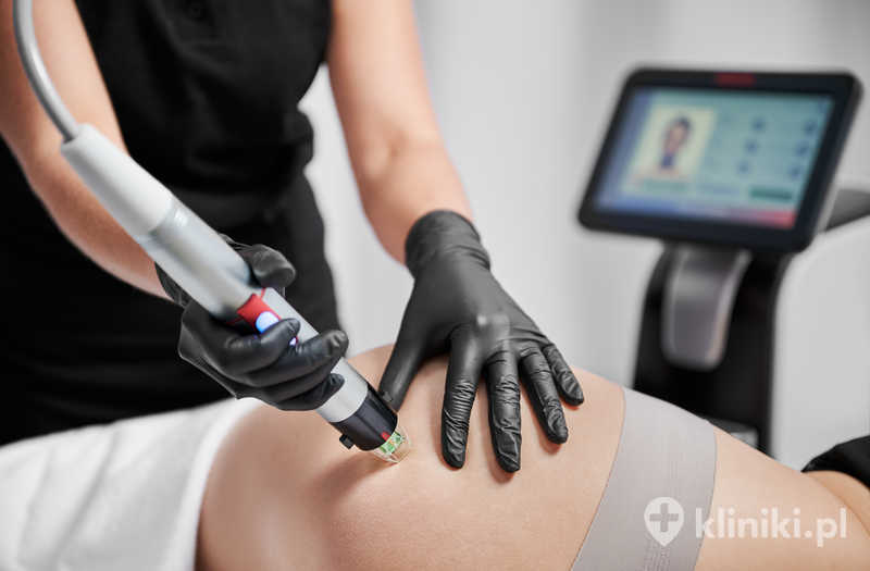 Zaleca się wykonywanie zabiegu Dermapen przypominającego co 3–6 miesięcy