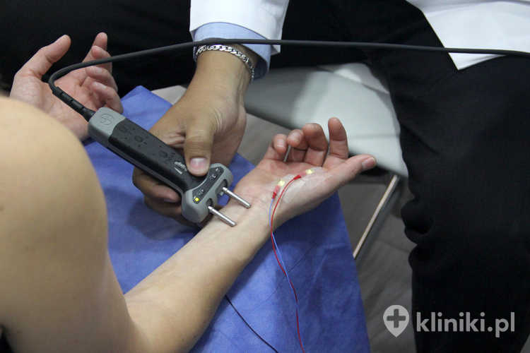 Badanie elektromiograficzne (EMG) oraz badanie somatosensorycznych potencjałów wywołanych (SSEP) ręki i ramienia pacjentki w celu diagnostyki zespołu cieśni nadgarstka, neuropatii obwodowych lub uszkodzenia nerwów
