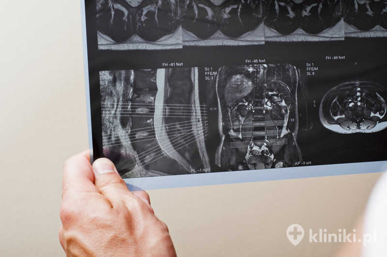 Badanie MRI pacjenta z patologią kręgosłupa Badanie MRI pacjenta z patologią kręgosłupa