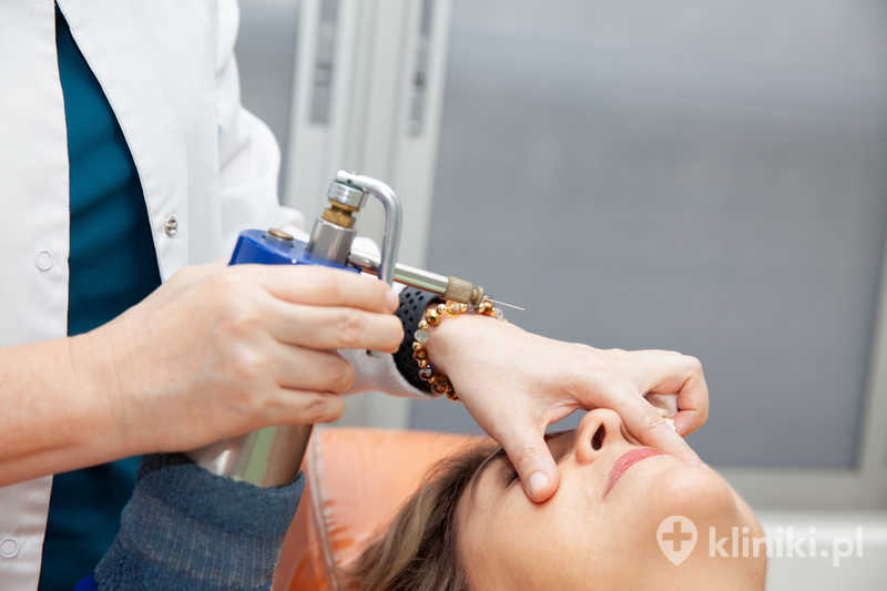Dermatolog wykonujący zabieg krioterapii zmian skórnych u starszej pacjentki Dermatolog wykonujący zabieg krioterapii zmian skórnych u starszej pacjentki