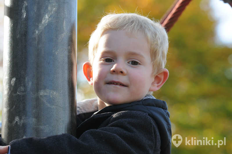 Plastyka uszu u dzieci zazwyczaj jest przeprowadzana po ukończeniu 5.–6. roku życia, gdy małżowiny uszne osiągną większość swojej docelowej wielkości. Plastyka uszu u dzieci zazwyczaj jest przeprowadzana po ukończeniu 5.–6. roku życia, gdy małżowiny uszne osiągną większość swojej docelowej wielkości.