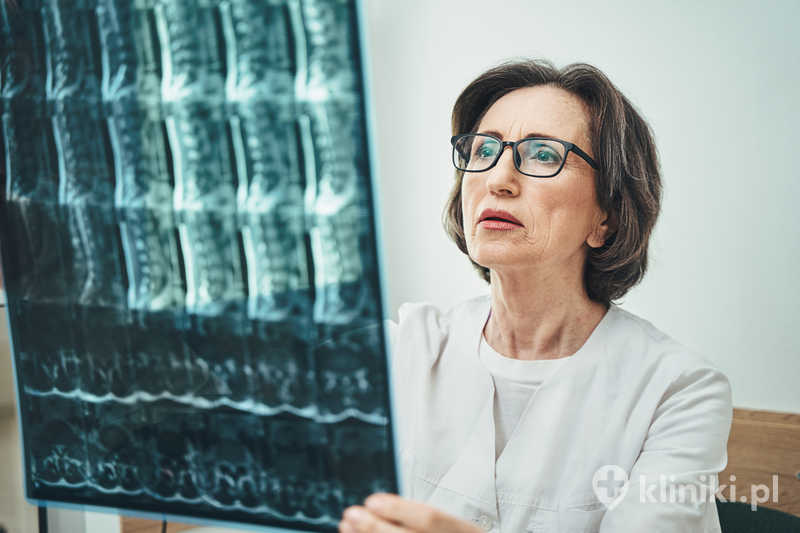 Skoncentrowana, doświadczona lekarka w okularach analizująca wyniki rezonansu magnetycznego odcinka lędźwiowego kręgosłupa Skoncentrowana, doświadczona lekarka w okularach analizująca wyniki rezonansu magnetycznego odcinka lędźwiowego kręgosłupa