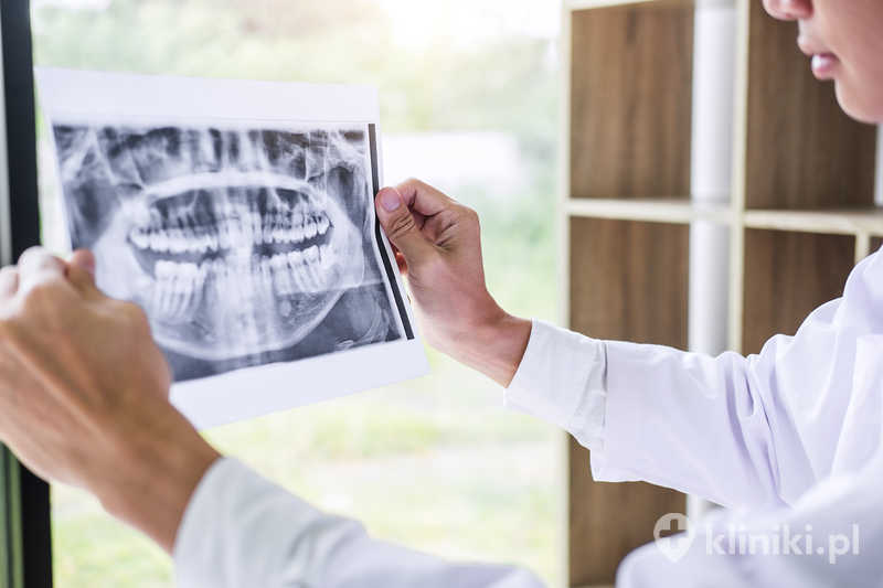 Zdjęcie lekarza lub dentysty trzymającego zdjęcie rentgenowskie zębów i przyglądającego się mu Zdjęcie lekarza lub dentysty trzymającego zdjęcie rentgenowskie zębów i przyglądającego się mu