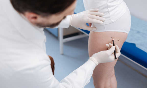 Choroby dyskwalifikujące do wykonania liposukcji wymagają indywidualnej oceny lekarskiej