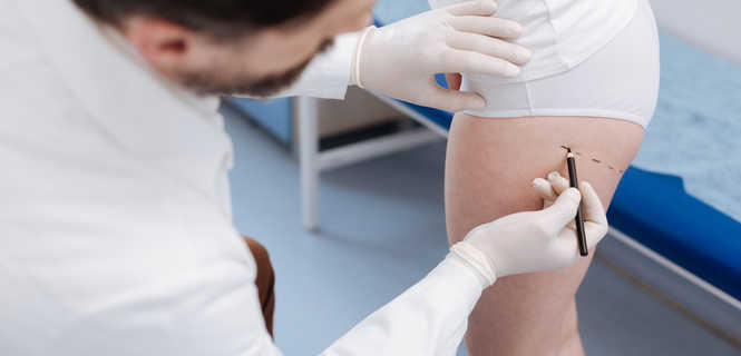 Jakie choroby dyskwalifikują do wykonania liposukcji?