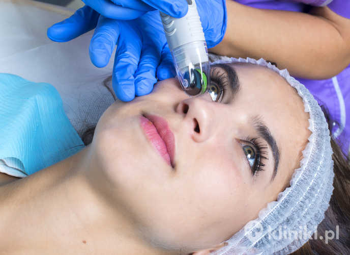 Medical cosmetic procedure. Mikronidling. Beautician performs Dermaroller procedure.