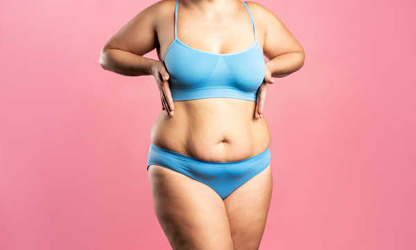 Modelowanie brzucha: liposukcja czy abdominoplastyka?