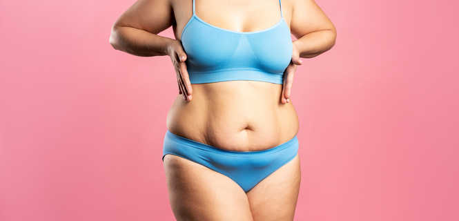 Modelowanie brzucha: liposukcja czy abdominoplastyka?