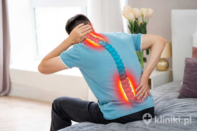 Ozonoterapia krążka międzykręgowego może zmniejszyć jego objętość i ucisk na korzenie nerwowe