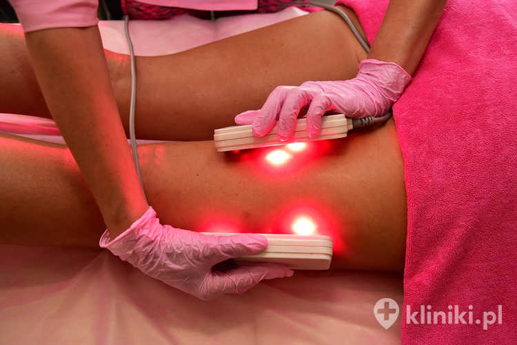 Terapia antycellulitowa i redukcja tkanki tłuszczowej w salonie kosmetycznym