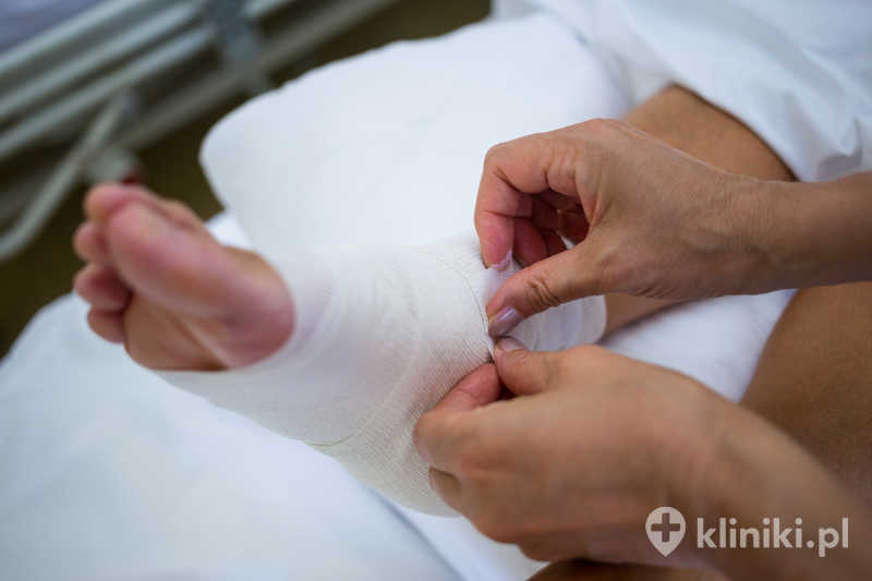 Rekonstrukcja więzadła strzałkowo-piętowego (CFL) służy przywróceniu stabilności stawu skokowego