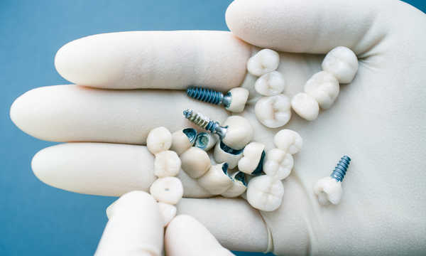Rodzaje implantów stomatologicznych