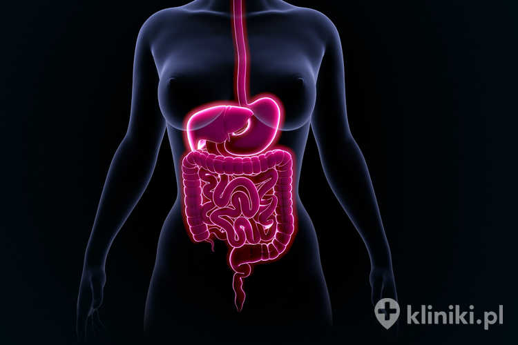 Kolonografia TK umożliwia wykrycie polipów, uchyłków oraz zmian nowotworowych we wczesnym stadium rozwoju
