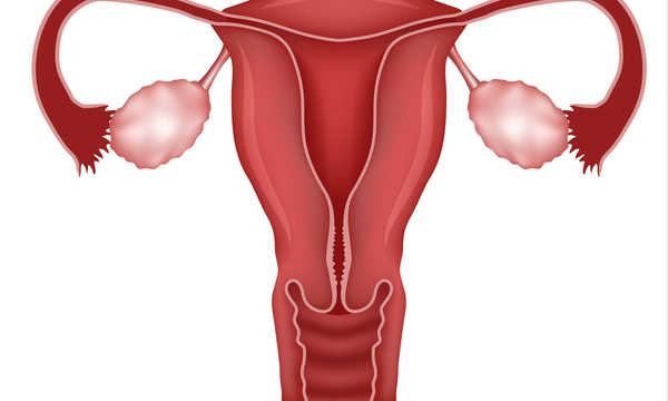 Elektrokauteryzacja jajników (skaryfikacja) jest zabiegiem laparoskopowym stosowanym u pacjentek z PCOS w celu przywrócenia owulacji