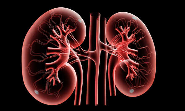 Metody usuwania kamieni nerkowych często wykorzystują kruszenie złogów falą uderzeniową