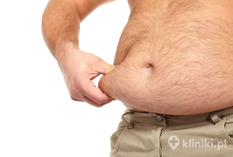 Leczenie otyłości przy pomocy balonu Medsil powinno być prowadzone pod kontrolą lekarza i połączone z opieką dietetyczną