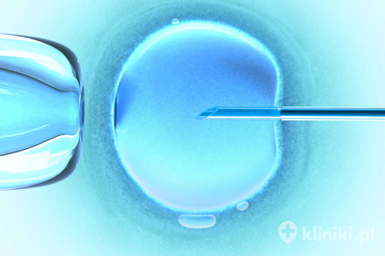 In vitro - zapłodnienie pozaustrojowe