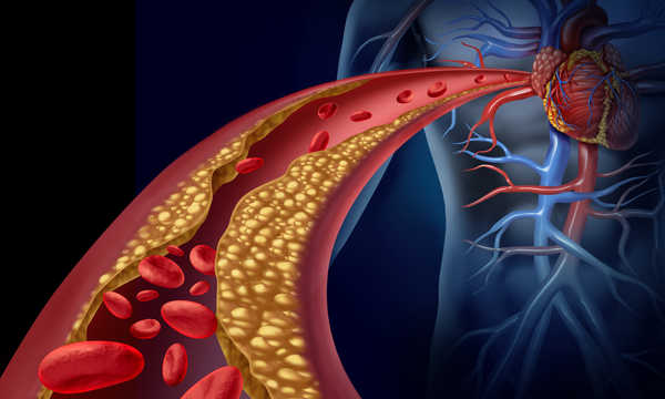 Lipofilling z zastosowaniem komórek macierzystych Lipogems