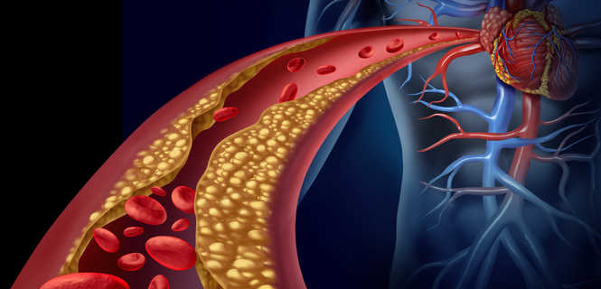 Lipofilling z zastosowaniem komórek macierzystych Lipogems