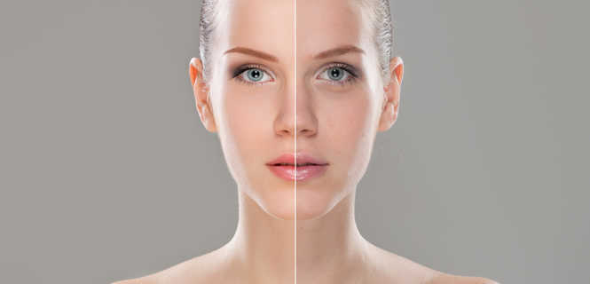 Peeling PRX-T33 - innowacyjna biorewitalizacja skóry